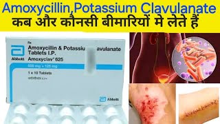 Amoxycillin and potassium clavulanate tablets ip  Amoxyclav 625 tablets  uses dosageside effect [upl. by Seibold]