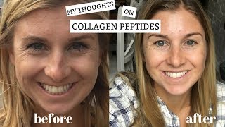 My Thoughts on Collagen Peptides  Benefits  Plus My Before and After [upl. by Bax]