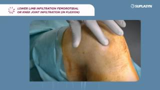 Suplasyn application on KNEE INFLEXION [upl. by Adnuhsor]