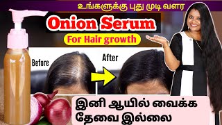 MIRACLE TIPS😱 இனி ஒவ்வொரு முடியும் புதுசா வளரும்  Best Onion Hair Growth Serum for Hair fall [upl. by Gulick36]