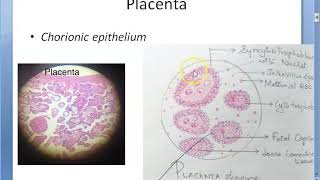 Obstetrics 243 GESTATIONAL TROPHOBLASTIC DISEASES Placental tumor Hydatidiform Mole Choriocarcinoma [upl. by Adaj]