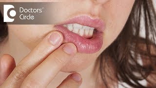 What causes herpes in private region  Dr Teena S Thomas [upl. by Ranie]