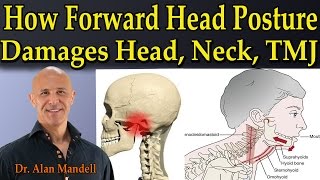 How Forward Head Posture Damages Head Neck amp TMJ  Dr Mandell [upl. by Cowley412]