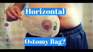 Wearing Your Ostomy Bag Horizontally FAQ [upl. by Blount]