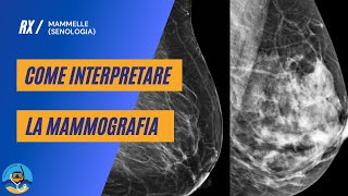 Come interpretare la mammografia [upl. by Anet]