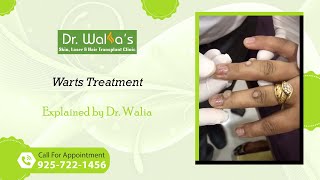 Warts Removal I Warts Treatment I How To Get Rid Of Warts [upl. by Derek]