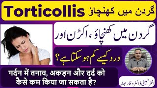 Torticollis گردن میں کھنچاؤ मन्यास्तंभ Homeopathic Treatmennt By Dr Waqar Bhutta In Urdu  Hindi [upl. by Aronel]