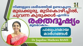 രക്തദൂഷ്യം നിങ്ങളുടെ ശരീരത്തെ എങ്ങനെയൊക്കെ ബാധിക്കുന്നു Dr Jaquline [upl. by Esorlatsyrc602]