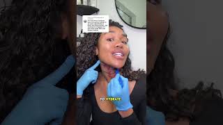 Neck tightening WITHOUT surgery neck looseskin antiagingtreatments [upl. by Atiuqrahc]