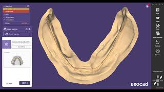 Designing complete dentures with Exocad Denture Module [upl. by Hawkie]