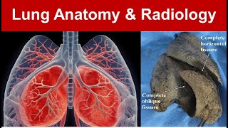 Lung Anatomy amp Radiology Gross Features Surfaces Borders and Azygous Lobe Part 1 TaimTalksMed [upl. by Elfrida994]