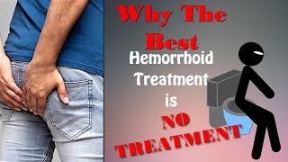 The Best Hemorrhoid Treatment Is No Treatment This May Shock You [upl. by Castorina672]