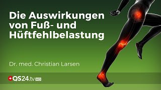 Knieprobleme vermeiden Die Bedeutung von Fuß und Hüftausrichtung  Dr Christian Larsen  QS24 [upl. by Adlare]