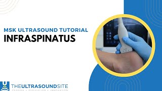 How to view the Infraspinatus tendon on ultrasound [upl. by Stratton]