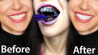 Fastest Way To Whiten Teeth At Home What REALLY Works [upl. by Shriver]