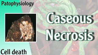 Pathophysiology  Caseous Necrosis Hani Laith شرح [upl. by Elma]