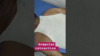 Scapular retraction [upl. by Siryt]