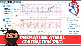 Rate and Rhythm  Premature Atrial Contraction PAC [upl. by Dnomed]