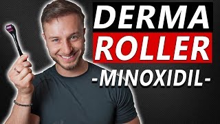 How To Use Derma Roller and Minoxidil to Regrow Hair [upl. by Akirahc]