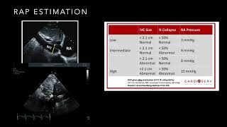 Right ventricle haemodynamics  pressures [upl. by Arrakat780]