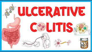 Ulcerative Colitis Causes Risk Factors Pathogenesis Clinical Presentation Diagnosis amp Treatment [upl. by Wagstaff68]