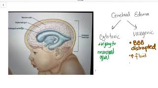 Cerebral Edema [upl. by Acinnor]