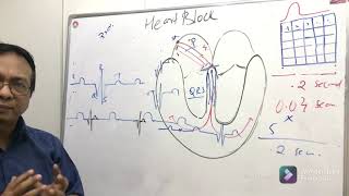 Heart Block [upl. by Hervey]