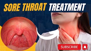 How to get rid of Sore throat  Sore throat remedies sore throat treatment  sore throat MHCP [upl. by Ybrek]