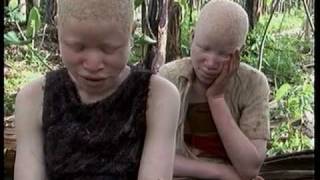 Deadly Hunt Albinos in Tanzania [upl. by Nalliuq801]