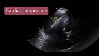 cardiac tamponade in a dog [upl. by Regnij]