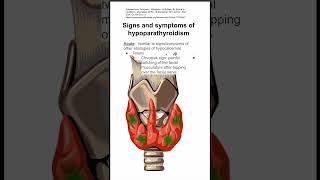 Signs and symptoms of hypoparathyroidism [upl. by Sugirdor]