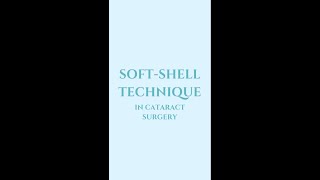 IN 60 SECONDS Soft Shell technique in cataract surgery [upl. by Ahsikar982]