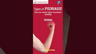 🤔 Are you struggling with psoriasis [upl. by Irac294]