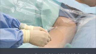 Having a Peripherally Inserted Central Catheter – PICC Arabic [upl. by Yrelav]