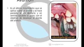 FISTUBE Odontología y Estática 01 Exodoncia versión 10 [upl. by Nadine]