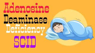 Adenosine Deaminase Deficiency  SCID  Lecture 8 [upl. by Naillij]