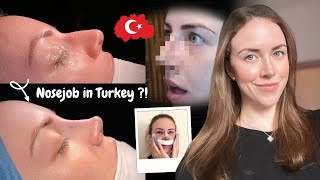 I Got a Nose Job in Istanbul  Turkey Rhinoplasty Vlog 2024 [upl. by Seale]