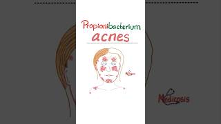 Propionibacterium acnes  Acne Vulgaris  Microbiology science microbiology nurse doctor mbbs [upl. by Ulrick]