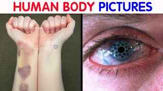 “My Eye Is Gradually Losing Its Color” 50 Interesting Human Body Pics [upl. by Atul]