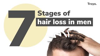 7 Stages of Hair Loss in Men  Right Time to Start the Treatment  Hair Regrowth  Traya Health [upl. by Ecneitap]