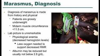 MARASMUS [upl. by Sharpe]