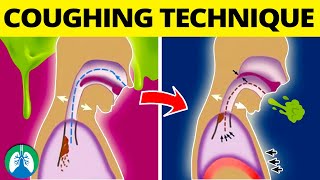 This COUGHING Technique Can Help Get Rid of Mucus and Phlegm ❗ [upl. by Desdee430]