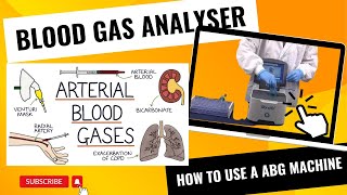 Blood Gas Analyzers  How to use a Blood Gas Analyser [upl. by Grenville]