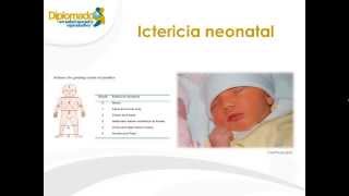 Ictericia neonatal [upl. by Till]