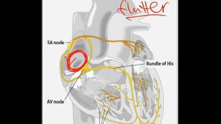 Atrial Flutter  Dr Jamal USMLE [upl. by Jacklyn]