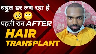 Hair Transplant के बाद पहली रात बहुत डर लग रहा है 🥺🙄 D2LifeVlogging hairtransplant [upl. by Frederick609]