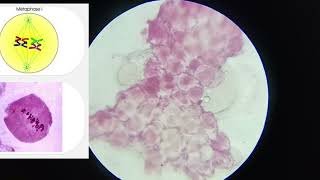 11th CLASS PRACTICAL  CELL DIVISION MEIOSIS 1 amp MEIOSIS 2  PROPHASE 5 STAGES  CBSE  GSEB bio [upl. by Gardel131]