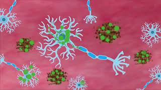 How fast are Alzheimer’s disease changes occurring in the brain [upl. by Eneryc534]