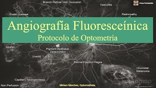 Angiografía Fluoresceínica Protocolo de Optometría [upl. by Cybill944]