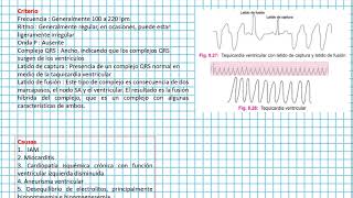 Taquicardia VENTRICULAR  Clases EKG 43 [upl. by Yeclek1]